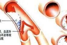 這些蔬菜是糖尿病的「天敵」，好吃不貴，吃一個好一個，快存！-頭條楓林網