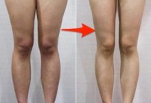 踢走象腿！8個有效瘦腿的生活習慣！-頭條楓林網