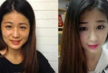 什麼祛斑方法好？哪種祛斑方法效果最好？幾百種方法等你來看！-頭條楓林網