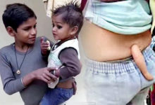 3歲印度小男童背後長了尾巴，每次要動手術移除時怪事連連！爸爸超自豪：「我兒子是猴神轉世！」-頭條楓林網