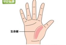 聚餐不怕吃多！她飯前捏手掌，四個月瘦下10公斤-頭條楓林網