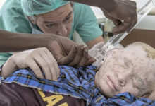 「膚色」與常人不一樣的他們成為被獵殺的對象，只因他們可被「提煉出藥水」！？-頭條楓林網