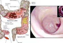 我確實喝「這杯水」一週，從頭到腳都變完美了！ 清潔胃壁、大小腸、疏通血脈全靠他！ 簡單到不行呀！-頭條楓林網