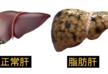 脂肪肝最怕這5種食物！ 能降脂、清血管，值得一試-頭條楓林網