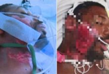 美國警察壓制28歲男子貼在77°C滾燙地面-頭條楓林網