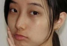 皮膚黑色素多，藥店十幾塊錢藥片，5天淡化色素30天皮膚白起來-頭條楓林網