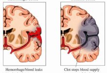 3個動作全身血液流通起來-頭條楓林網