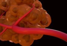 中科院最新納米機器人成功“餓死”小鼠腫瘤！ 聯合美國團隊共同打造一種完全自主的 DNA 納米機器人-頭條楓林網