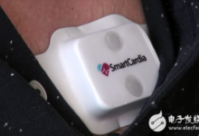 Smartcardia開發無線電子貼片取代監測儀器-頭條楓林網