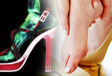女性要小心！穿「高跟鞋」對腳的危害有多大？看完這個研究報告後，女生都不再穿了！-頭條楓林網