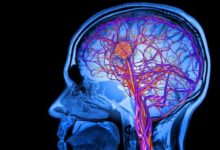 解密“腦控信徒”-頭條楓林網