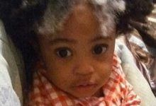 兩歲男孩的頭髮上有一條亮白的胎記條紋-頭條楓林網