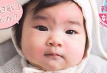 寶寶反覆咳喘、腹瀉便秘、總蹭鼻子揉眼睛…可能是過敏！-頭條楓林網
