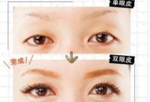 有什麼辦法可以讓眼睛變大？ 小眼睛變大的方法-頭條楓林網