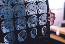 新研究證實睡眠不足易罹患失智症-頭條楓林網