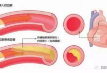 你的血管決定你的壽命-頭條楓林網