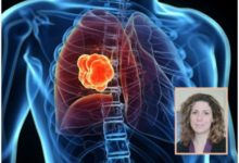 美研究發現新療法 雙管齊下“餓死”癌細胞-頭條楓林網