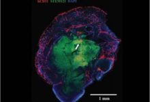 重大突破！移植到鼠腦的微型人腦長出毛細血管-頭條楓林網