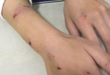 親身體驗告訴你們：千萬不要當貓面和別人打架，否則自己就要遭殃-頭條楓林網