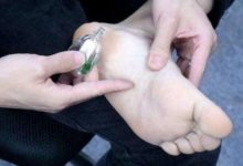 睡覺前在腳底抹2滴風油精，沒想到還有這麼大的作用，又漲知識了-頭條楓林網