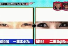 並非所有的人都喜歡整成錐子臉！但這些日本人的整容理由實在讓人難以接受…-頭條楓林網