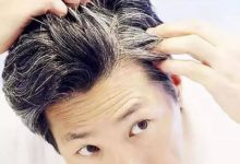 你知道少白頭是什麼原因導致的嗎-頭條楓林網