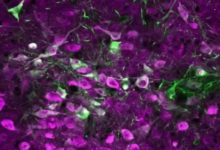 研究證實 血清素增強大腦可塑性-頭條楓林網