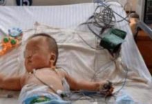 又一位寶寶被診斷為腎衰竭，家長們別再給孩子吃這種輔食了-頭條楓林網