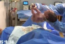 孕婦6年剖腹產4次，看到子宮，醫生們無從下刀：「一灘爛泥」！-頭條楓林網