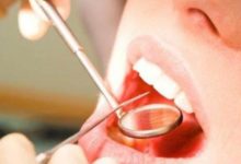 很多人對牙齦出血不當回事，等真的出現意外，後悔就晚了。-頭條楓林網