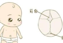 眾道妙方叫你如何判斷囟門早閉！-頭條楓林網