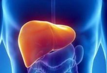 備孕男人精子質量的提高方法：不孕不育中的隱形殺手——脂肪肝-頭條楓林網
