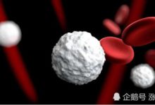 癌細胞會被餓死？這樣的舉動或會成為治療癌症的新興方式-頭條楓林網