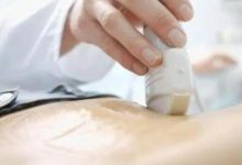 做B超時，塗在肚子上「黏黏」的是什麼？今天才知道！-頭條楓林網