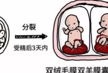 懷雙胞胎時，竟會出現這樣的問題？-頭條楓林網