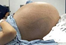 孕婦誕下8胞胎，老公欣喜若狂：棉襖越多越好，這個冬天夠暖和！-頭條楓林網