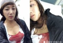 最倒霉的女星:整容五次,縫20多針,竟都是因為大牌女星的狗!-頭條楓林網