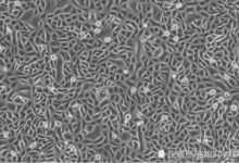 1.25億年前的古老皮屑，解釋古生物進化的謎底！-頭條楓林網