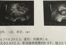 兩次生化后終於完美翻倍了！我終於能當時媽媽咯！-頭條楓林網