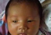 新生兒黃疸葡萄糖不一定好用！如何及時有效退黃疸？-頭條楓林網