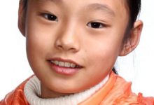 南大四附院眼視光門診：發現幼兒視力問題2步曲-頭條楓林網