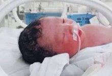 先兆流產、胎盤低、保胎、宮腔積液、大出血，攤上了早產所有問題-頭條楓林網