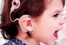 兒童助聽器的選配原則有哪些？-頭條楓林網