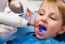 哎呀！我的寶寶乳牙怎麼長歪了！這要怎麼辦？-頭條楓林網