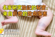 名家研究胎記的秘密：來自前世的致命傷害-頭條楓林網
