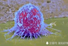 對抗腫瘤最簡單的方法：吃這種糖類能很好的抑制某些腫瘤-頭條楓林網