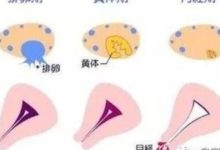 試管嬰兒促排卵方案最全攻略，看看哪些方案適合你-頭條楓林網